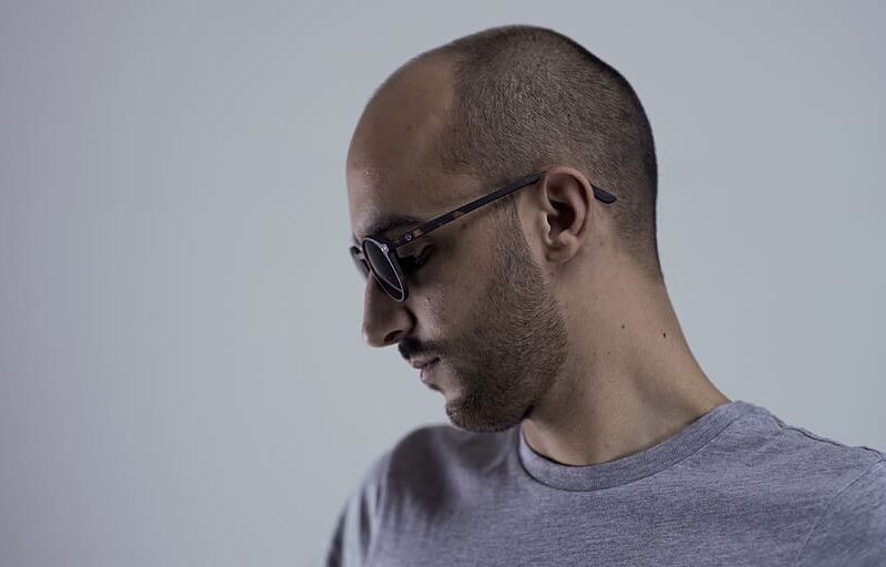 When Will Male Hair Loss Stop